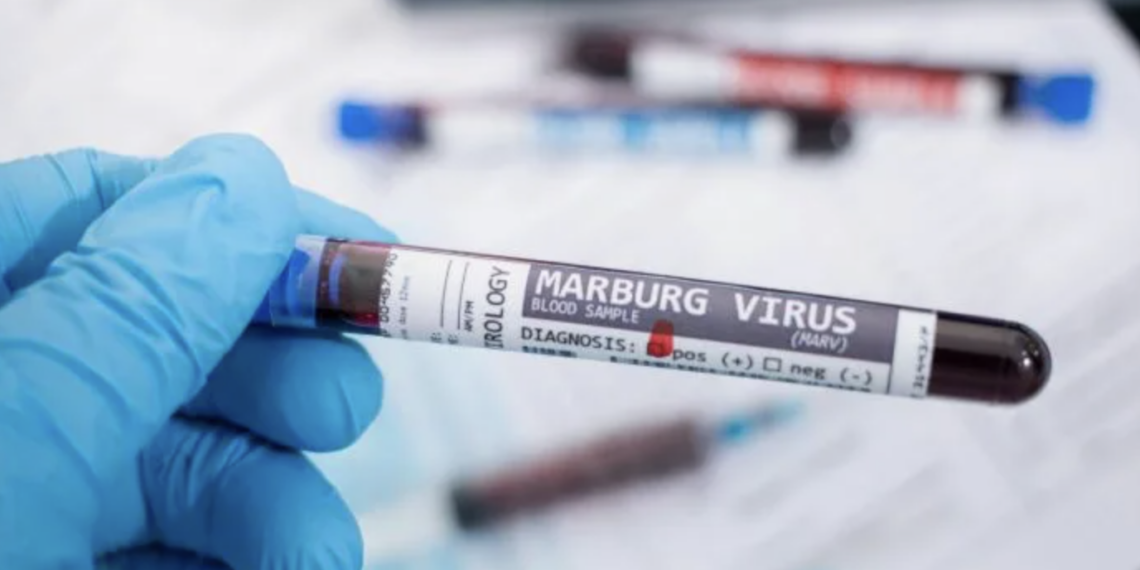 Минздрав РК усиливает контроль за эпидемиологической ситуацией на фоне предупреждения ВОЗ о вирусе Марбурга