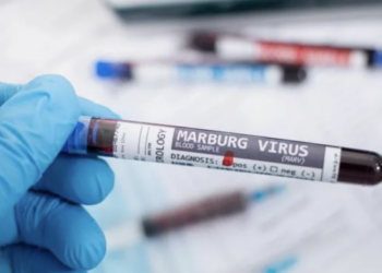 Минздрав РК усиливает контроль за эпидемиологической ситуацией на фоне предупреждения ВОЗ о вирусе Марбурга